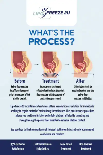 Diagram of how incontinence treatment Wigston works.
