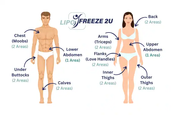 Areas you can have fat freezing treatment Wigston