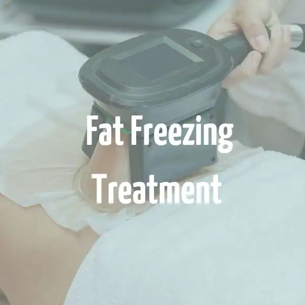 fat freezing treatment Wigston