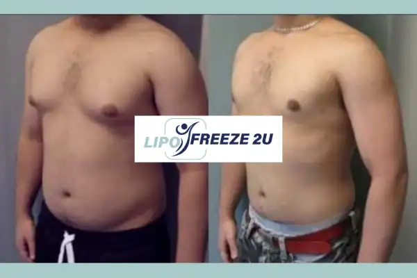 How Long Does It Take to See Results Wigston?