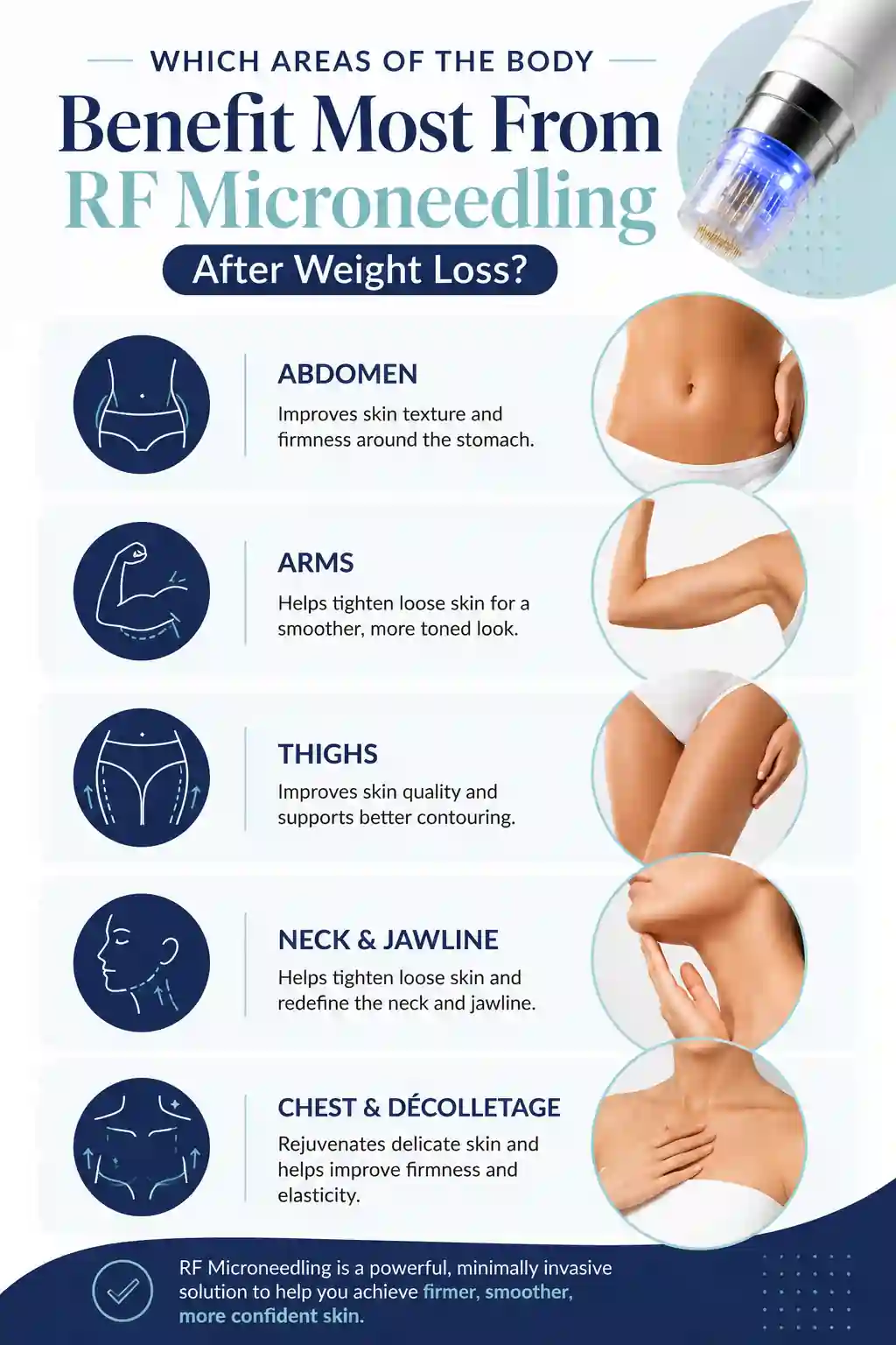Which Areas of the Body Benefit Most From RF Microneedling After Weight Loss Wigston